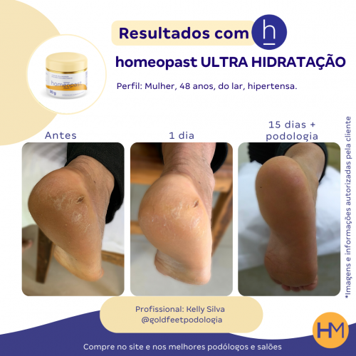 Ultra Hidratação